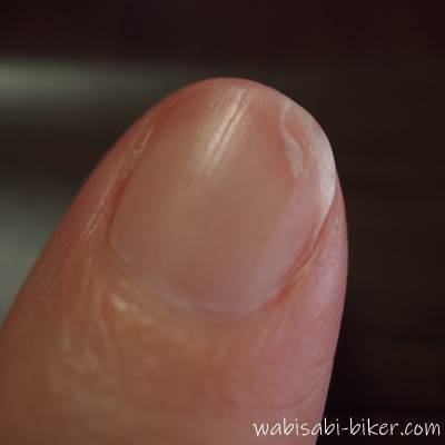 40代 素の指の爪
